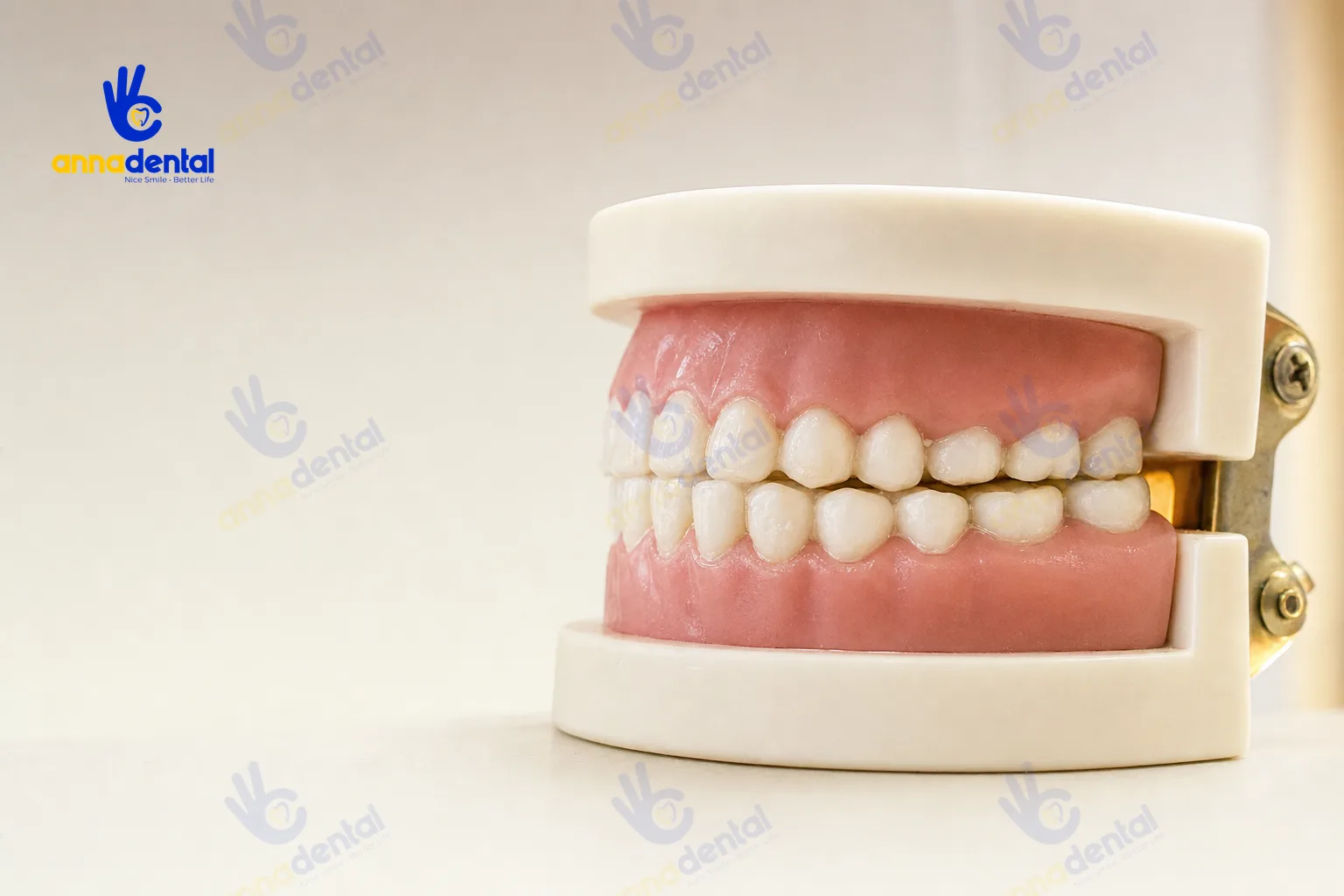 Mô hình răng trẻ em với mặt nhai hơi mòn do nghiến răng