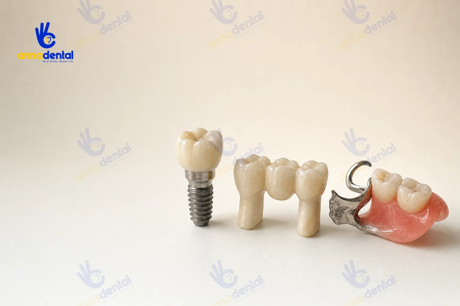 Ba lựa chọn phục hình răng hàm: Implant, cầu răng sứ và hàm tháo lắp