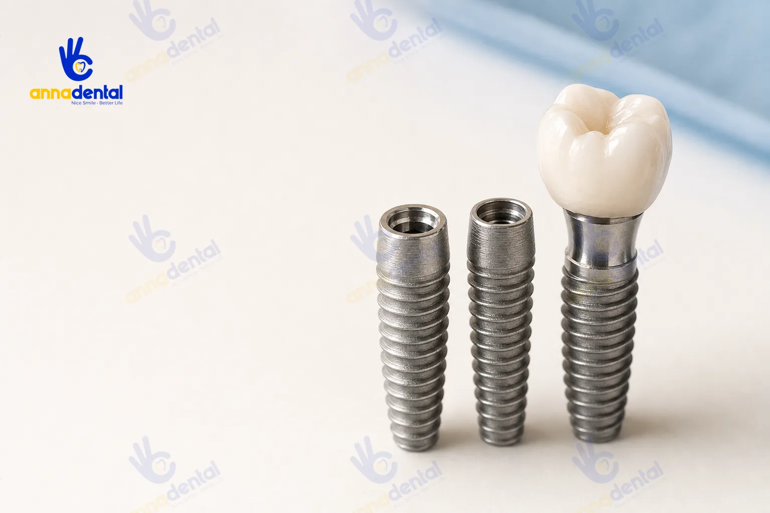 Cận cảnh trụ Implant và mão sứ minh họa trồng răng Implant có nên không, rủi ro và cách chọn nha khoa