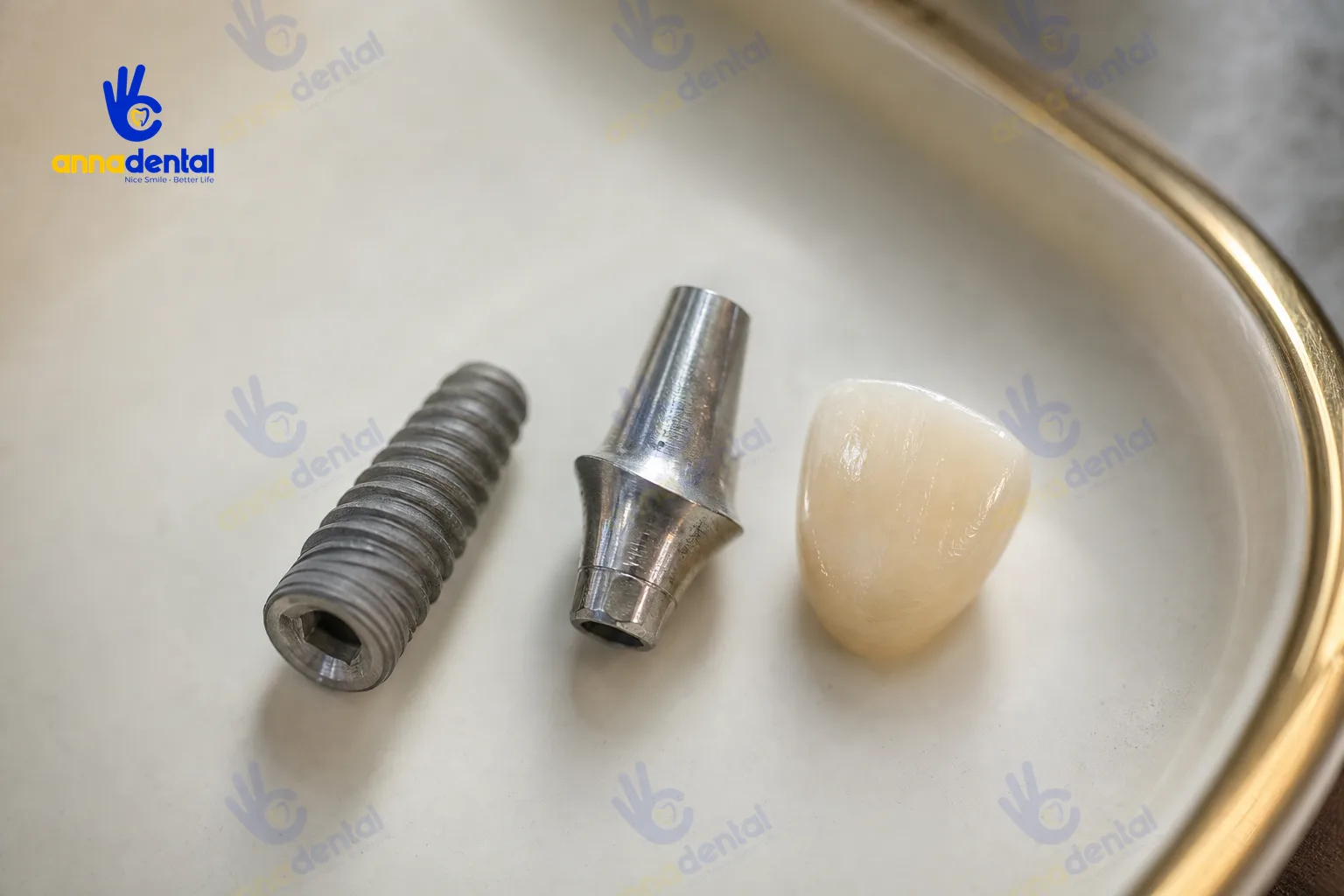 Bộ ba trụ implant, abutment và mão sứ trồng răng implant răng cửa trên khay men sạch