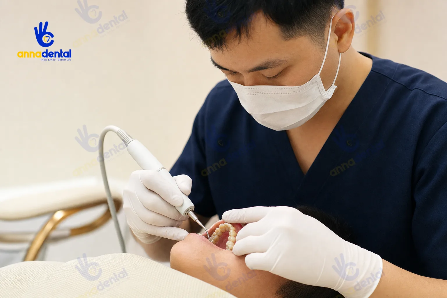 Lấy cao răng điều trị viêm lợi và phòng ngừa viêm nha chu