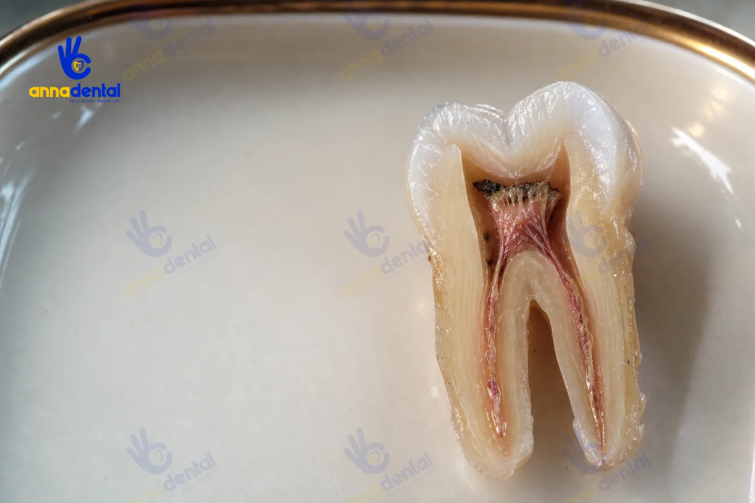 Viêm tủy răng: dấu hiệu nhận biết và hướng điều trị hiệu quả